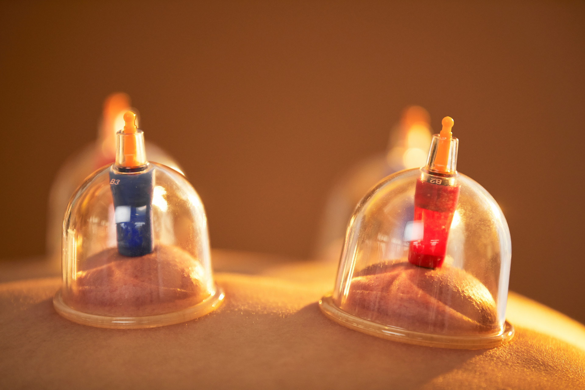 Enhancing Therapeutic Effects: The Benefits of Warm Water Cupping