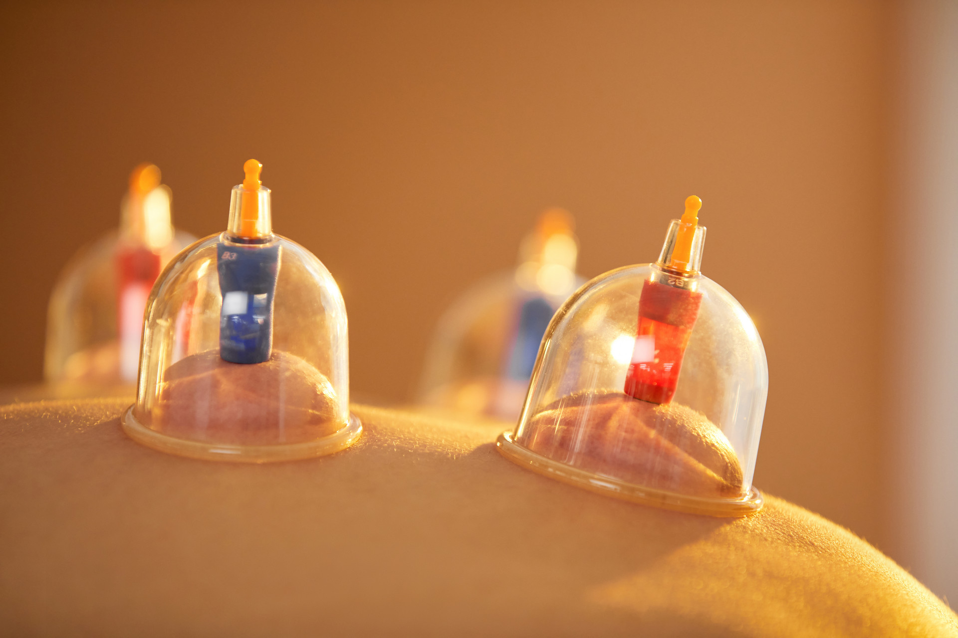 The Cupping Ironing Method: A Technique for Effective Acupoint Massage and Skin Treatment