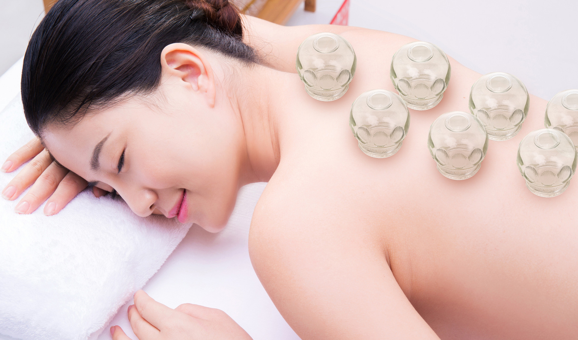 Enhancing Health and Well-being through Cupping Therapy