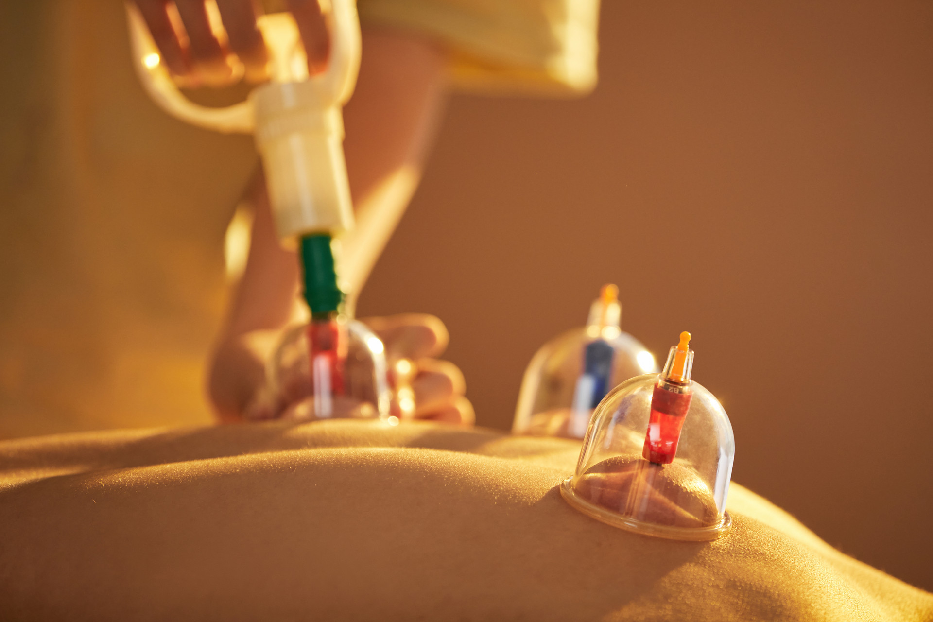 The Effectiveness of Massage Cupping for Pain Relief and Injury Recovery