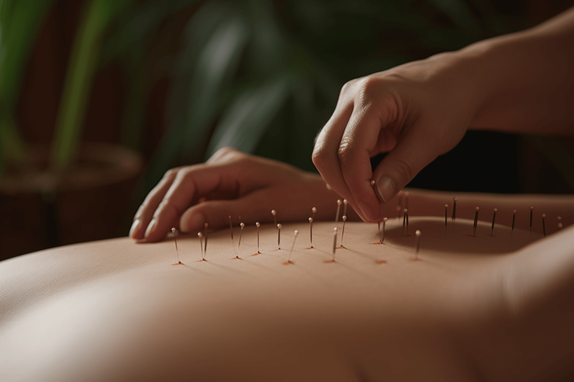 Acupuncture: Treating Neurotoxicity and Preventing Drug Toxicity Reactions