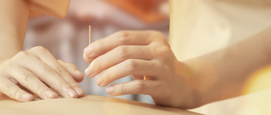 Precautions for Needling in Specific Patient Populations and Areas of the Body