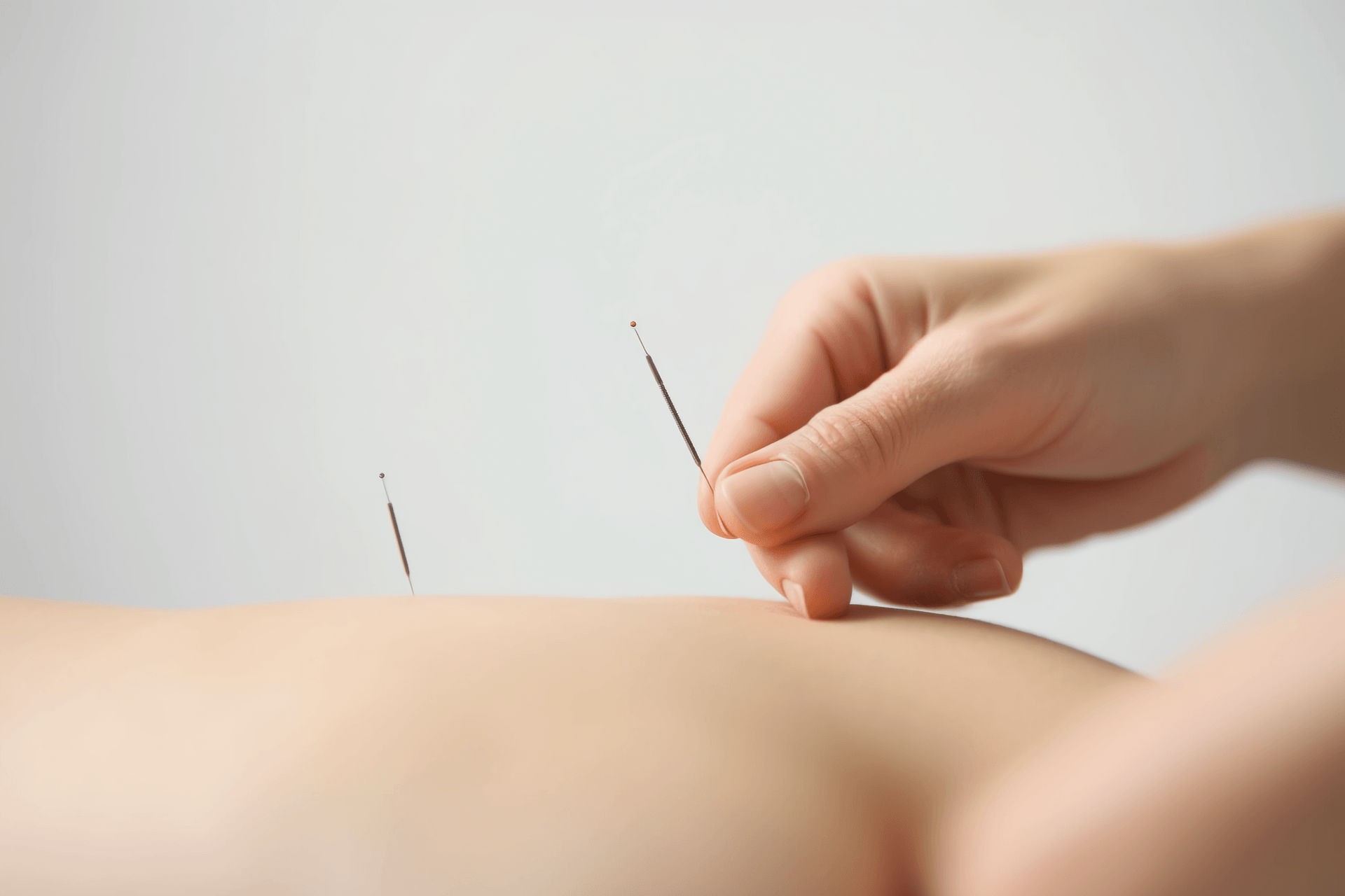 Skin Needle Therapy: Ancient Chinese Needling Techniques for Promoting Health and Treating Diseases