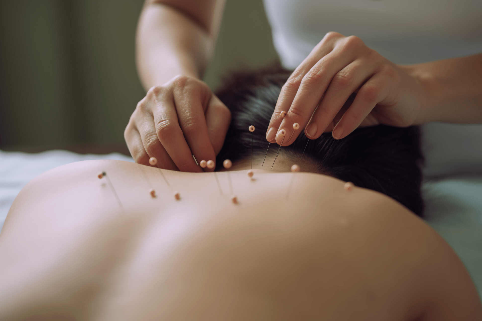 Hand Needle Therapy: A Traditional Chinese Medicine Approach to Treating Diseases