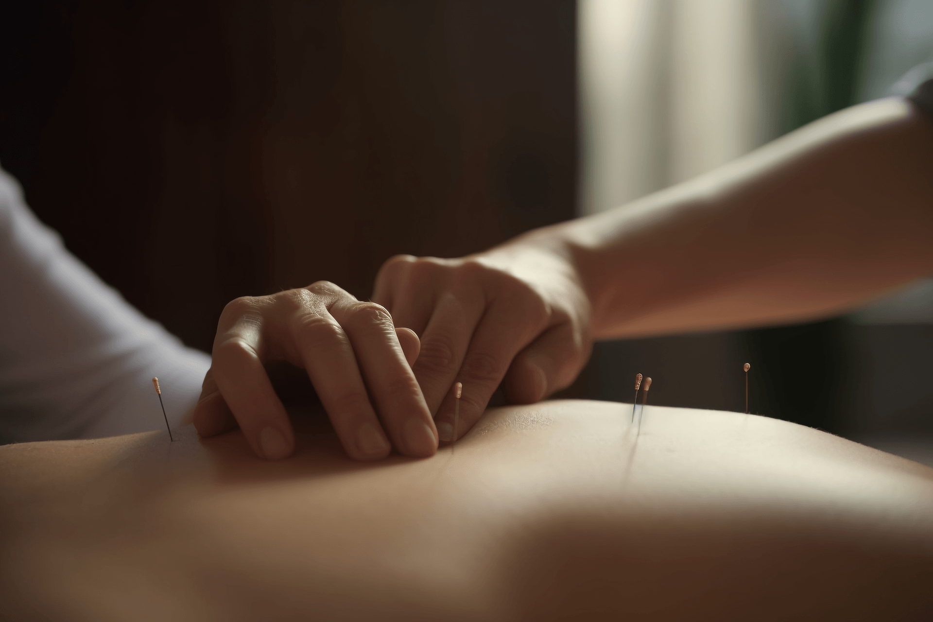 Acupuncture Embedding Therapy: A Long-lasting Solution for Chronic Conditions