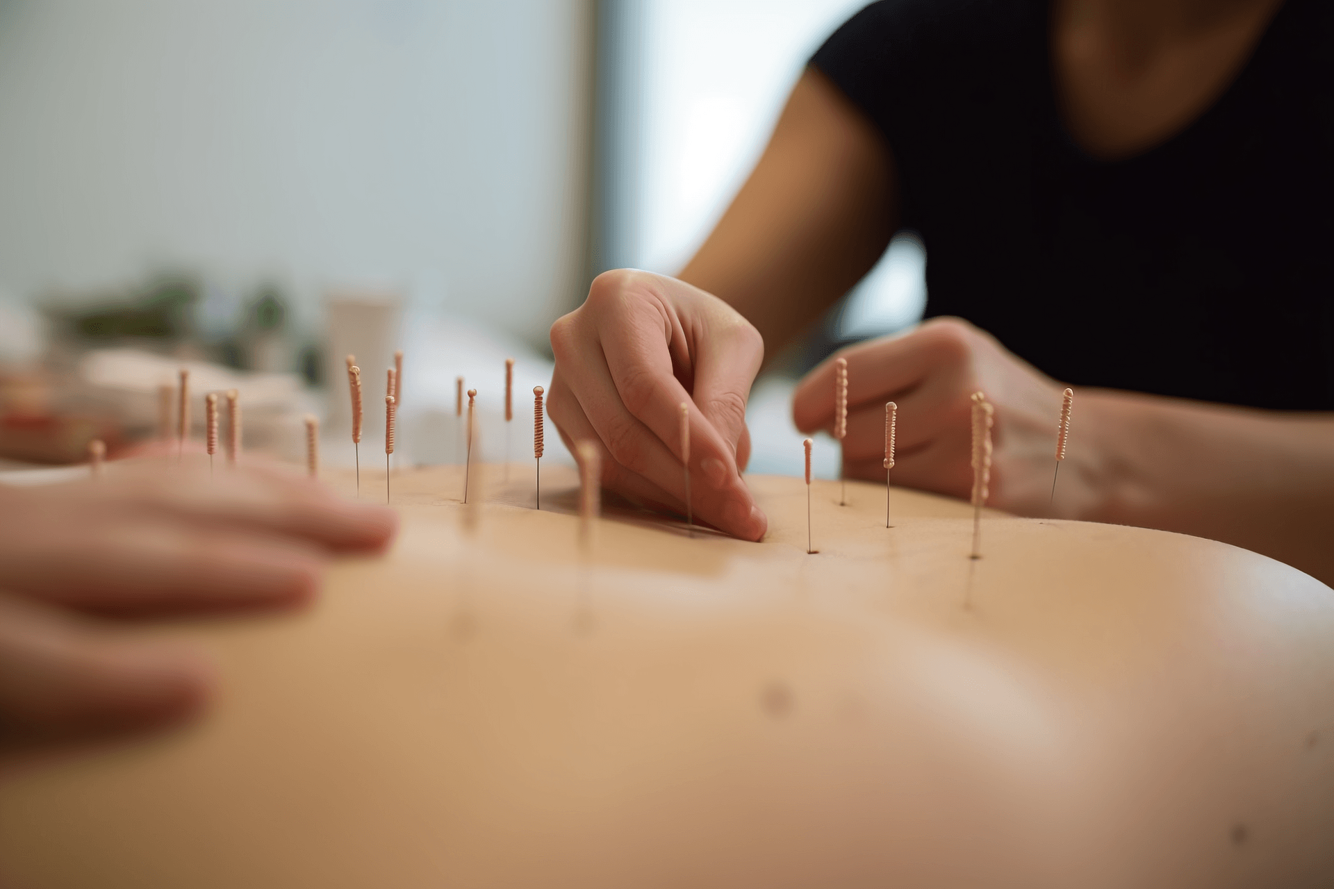 Accurate Localization Methods for Acupoint Selection in Acupuncture