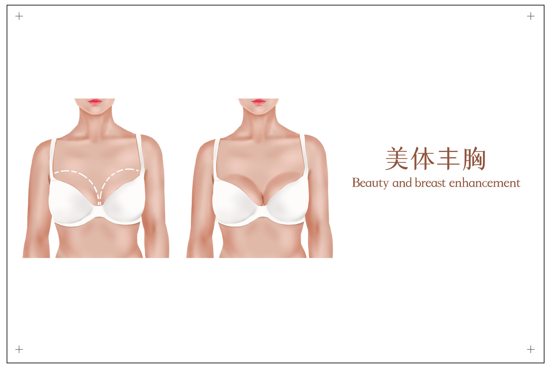 Enhancing Breast Health with Chinese Medicinal Herbs