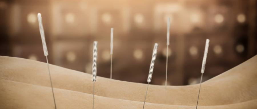 The Role of Acupuncture in Treating Infectious Diseases: An Ancient Therapy for Modern Health